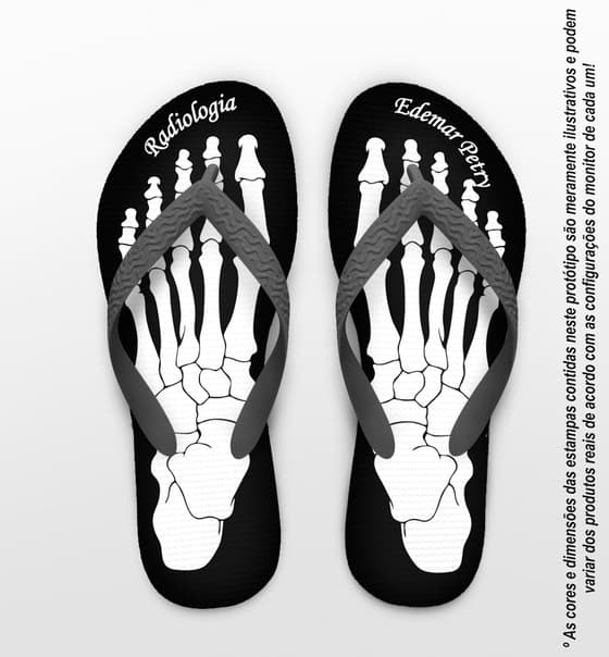 Chinelo Formatura Radiologia Ossos Personalizado COD 3658